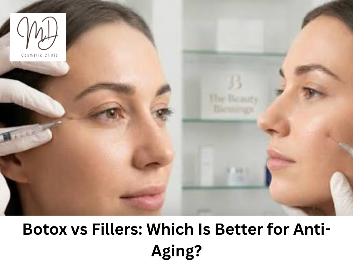 Botox vs fillers