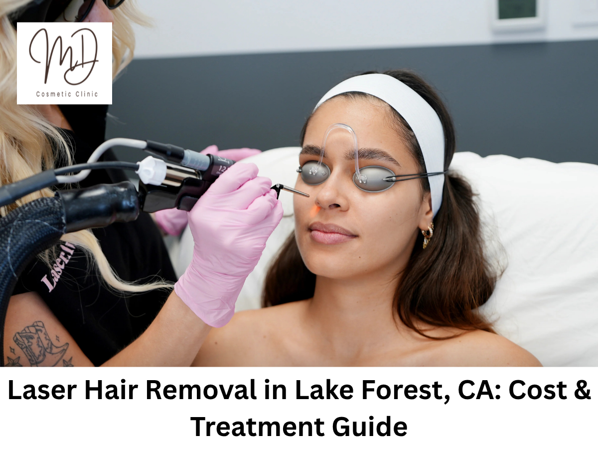 laser hair removal in Lake Forest