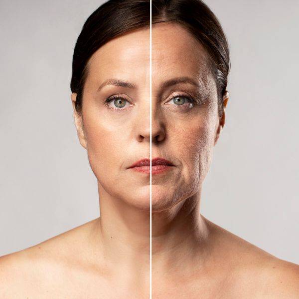 Non-surgical-facelift